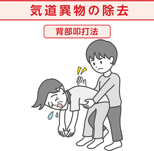気道異物の除去