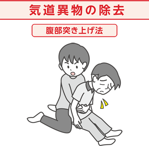 気道異物の除去